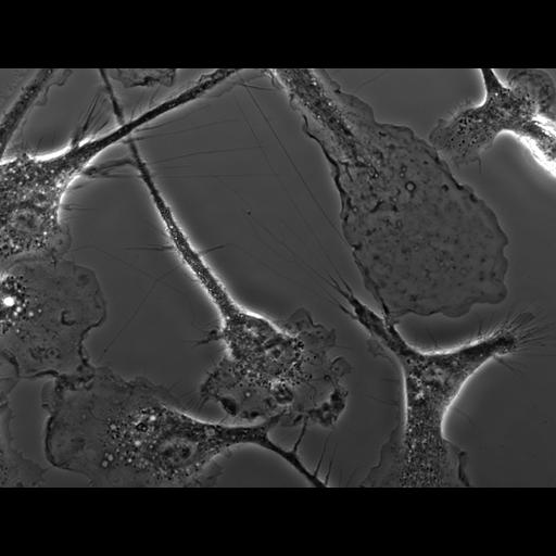  NCBI Organism:Mus musculus; Cell Types:macrophage Cell Components:ruffle membrane Biological process:cell motility