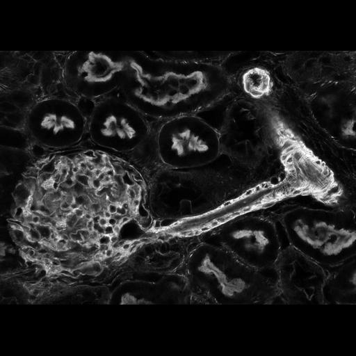  NCBI Organism:Rattus rattus; Cell Types:podocyte (sensu Diptera), epithelial cell; Cell Components:actin cytoskeleton Biological process:renal system process