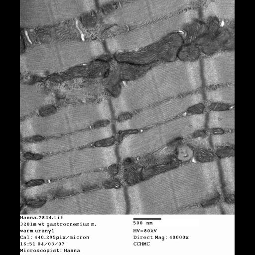  NCBI Organism:Mus musculus; Cell Types:skeletal muscle cell Cell Components:dystroglycan complex Biological process:plasma membrane organization