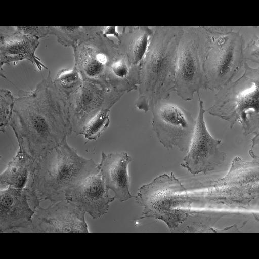  NCBI Organism:Mus musculus; Cell Types:fibroblast Cell Components:ruffle Biological process:cell motility