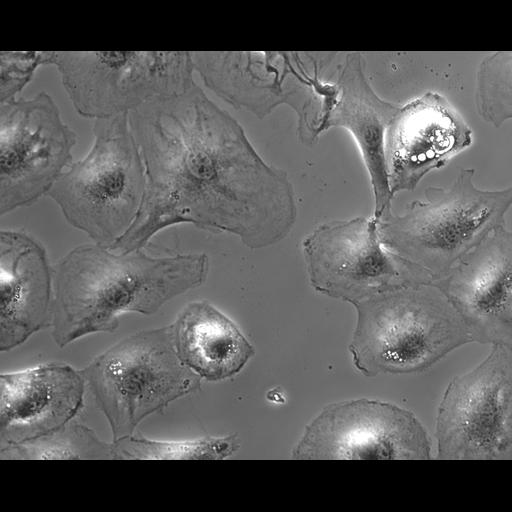  NCBI Organism:Mus musculus; Cell Types:fibroblast Cell Components:ruffle Biological process:cell motility