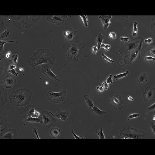  NCBI Organism:Mus musculus; Cell Types:fibroblast Cell Components:ruffle Biological process:cell motility