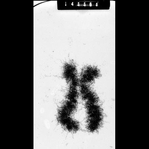  NCBI Organism:Homo sapiens; Cell Components:condensed chromosome Biological process:nuclear division, chromosome organization, mitosis;