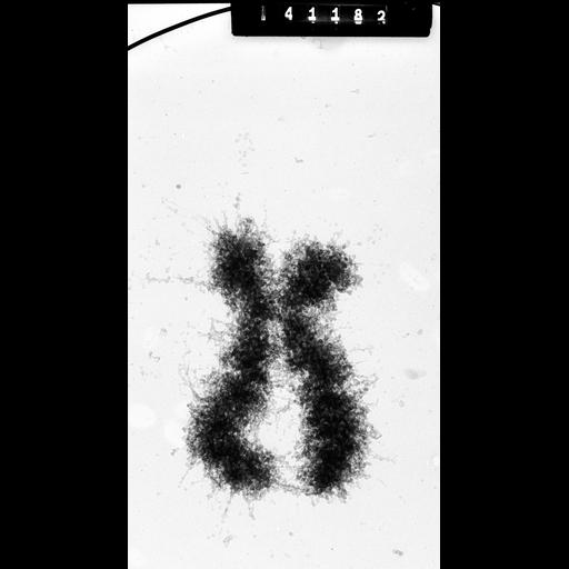  NCBI Organism:Homo sapiens; Cell Components:condensed chromosome Biological process:nuclear division, chromosome organization, mitosis;