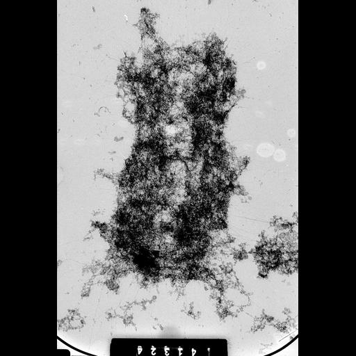  NCBI Organism:Homo sapiens; Cell Components:condensed chromosome Biological process:nuclear division