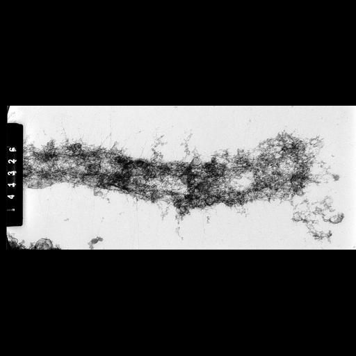  NCBI Organism:Homo sapiens; Cell Components:condensed chromosome Biological process:nuclear division