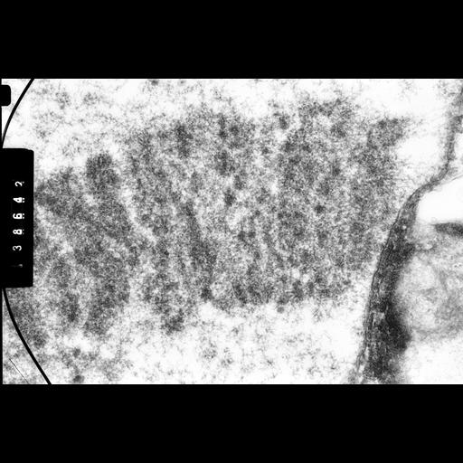  NCBI Organism:Drosophila melanocephala; Cell Components:polytene chromosome