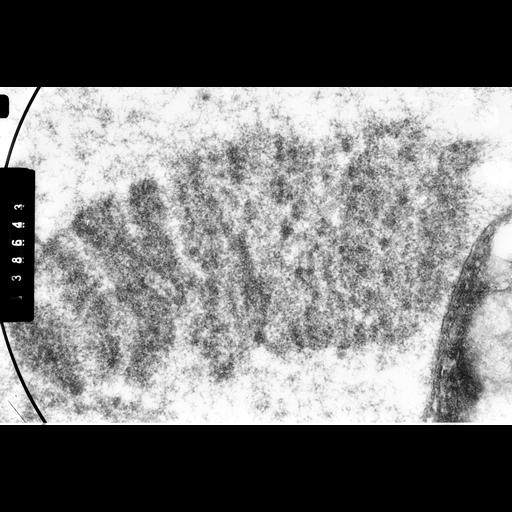  NCBI Organism:Drosophila melanocephala; Cell Components:polytene chromosome