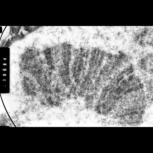  NCBI Organism:Drosophila melanogaster; Cell Components:polytene chromosome Biological process:chromosome organization