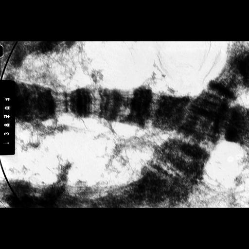  NCBI Organism:Drosophila melanocephala; Cell Components:polytene chromosome