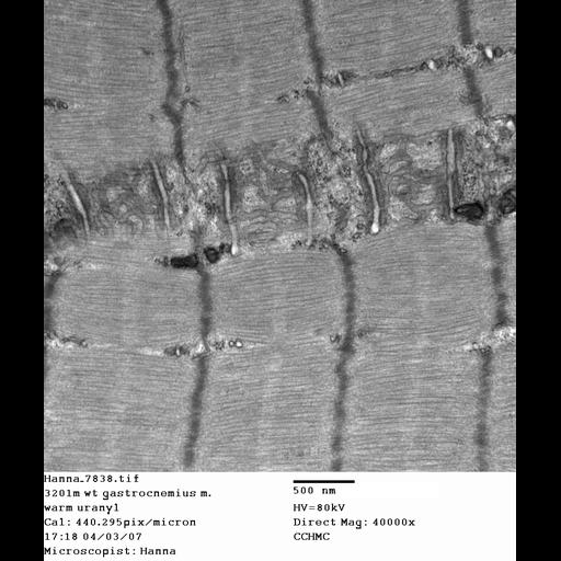  NCBI Organism:Mus musculus; Cell Types:skeletal muscle cell Cell Components:dystroglycan complex Biological process:plasma membrane organization