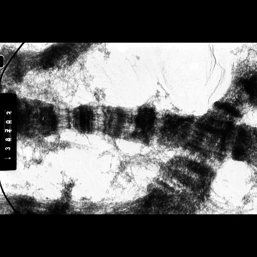  NCBI Organism:Drosophila melanocephala; Cell Components:polytene chromosome