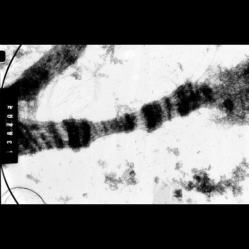  NCBI Organism:Drosophila melanocephala; Cell Components:polytene chromosome