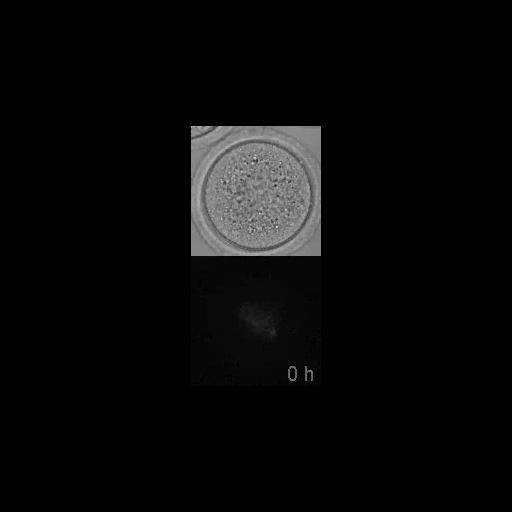  NCBI Organism:Mus musculus; Cell Types:oocyte Cell Components:microtubule, microtubule organizing center part, nuclear chromosome; Biological process:meiotic spindle organization, microtubule organizing center organization;