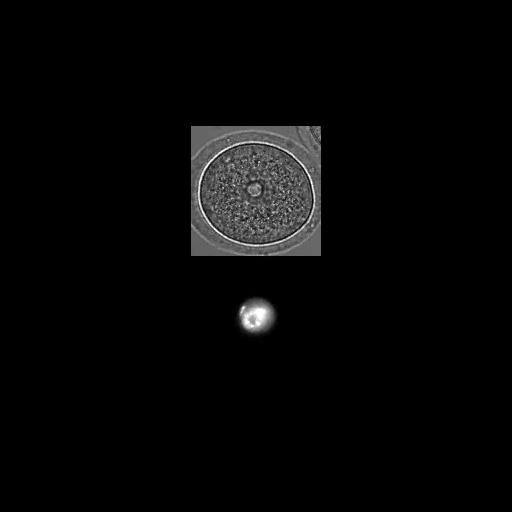  NCBI Organism:Mus musculus; Cell Types:oocyte Cell Components:microtubule, microtubule organizing center part, nuclear chromosome; Biological process:meiotic spindle organization, microtubule organizing center organization;