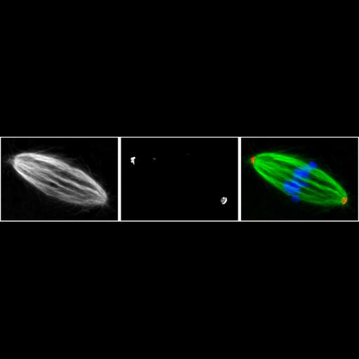  NCBI Organism:Mus musculus; Cell Types:oocyte Cell Components:microtubule, microtubule organizing center part, nuclear chromosome; Biological process:meiotic spindle organization, microtubule organizing center organization;