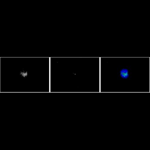  NCBI Organism:Mus musculus; Cell Types:oocyte Cell Components:microtubule, microtubule organizing center part, nuclear chromosome; Biological process:meiotic spindle organization, microtubule organizing center organization, RNA interference;