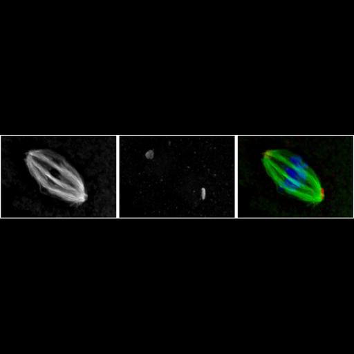  NCBI Organism:Mus musculus; Cell Types:oocyte Cell Components:microtubule, microtubule organizing center part, nuclear chromosome; Biological process:meiotic spindle organization, microtubule organizing center organization;