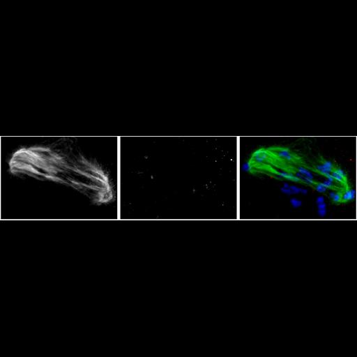  NCBI Organism:Mus musculus; Cell Types:oocyte Cell Components:microtubule, microtubule organizing center part, nuclear chromosome; Biological process:meiotic spindle organization, microtubule organizing center organization, RNA interference;