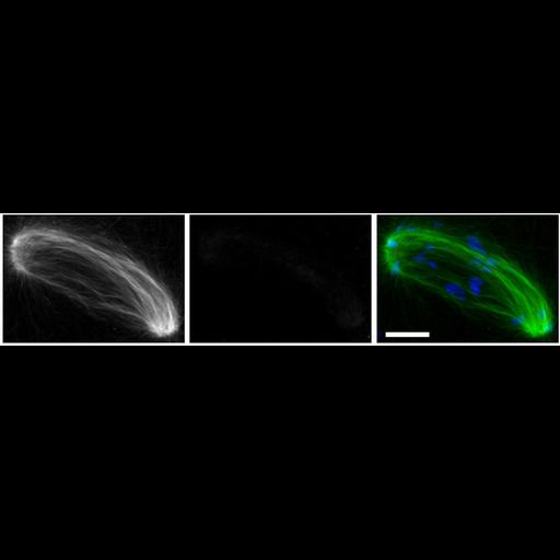  NCBI Organism:Mus musculus; Cell Types:oocyte Cell Components:microtubule, microtubule organizing center part, nuclear chromosome; Biological process:meiotic spindle organization, microtubule organizing center organization, RNA interference;