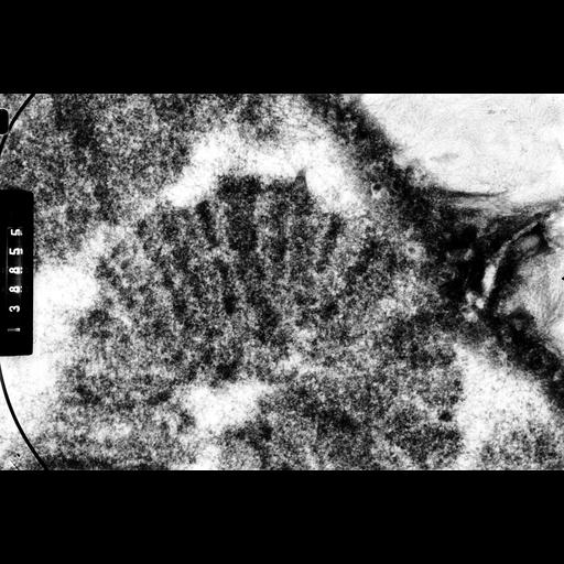  NCBI Organism:Drosophila melanocephala; Cell Components:polytene chromosome