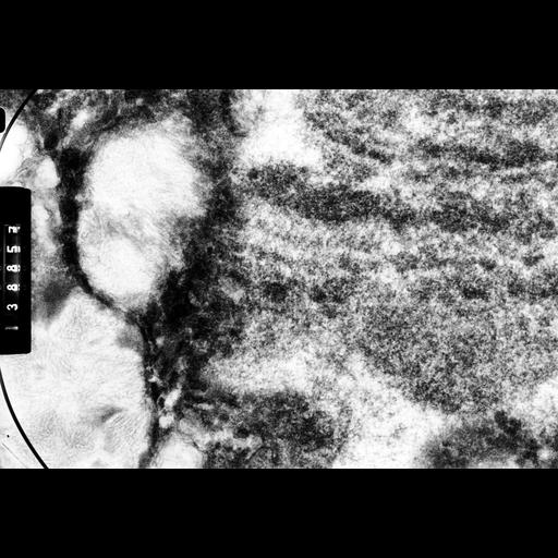  NCBI Organism:Drosophila melanocephala; Cell Components:polytene chromosome