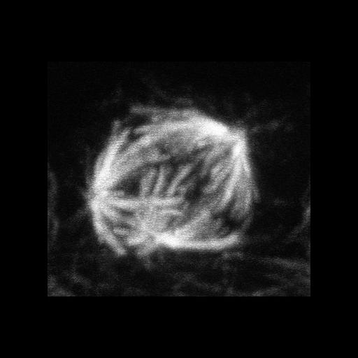  NCBI Organism:Homo sapiens; Cell Types:hepatocyte Cell Components:spindle microtubule Biological process:mitotic metaphase, cytokinesis, chromosome segregation, chromosome organization;