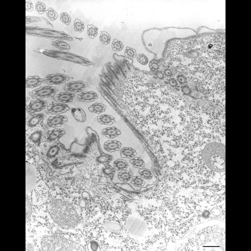  NCBI Organism:Tetrahymena pyriformis; Cell Types:cell by organism, eukaryotic cell, , ; Cell Components:oral apparatus Biological process:oral apparatus organization