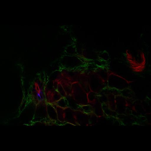  NCBI Organism:Rattus rattus; Cell Types:duct epithelial cell, hepatocyte, ; Cell Components:keratin filament, , actin filament; Biological process:cell proliferation