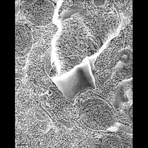  NCBI Organism:Paramecium multimicronucleatum; Cell Types:cell by organism, eukaryotic cell, , ; Cell Components:contractile vacuole, cytoplasm, contractile vacuolar membrane, microtubule, microtubule associated complex; Biological process:contractile vacuole organization, cytoplasm organization, microtubule-based process, microtubule cytoskeleton organization;