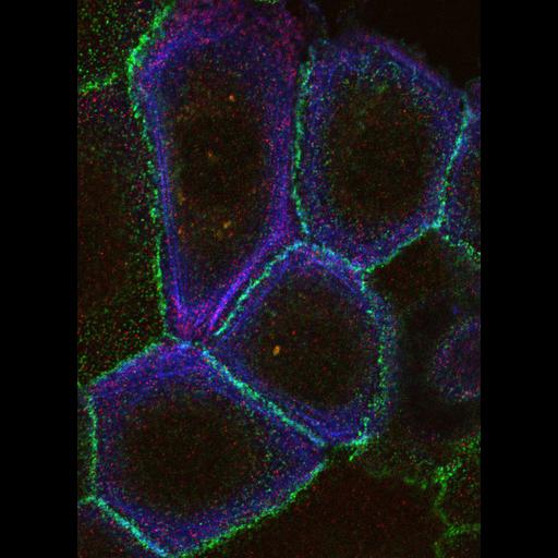  NCBI Organism:Homo sapiens; Cell Types:keratinocyte Cell Components:actin filament, , , adherens junction; Biological process:, ;