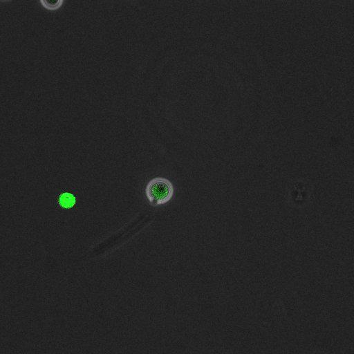  NCBI Organism:Saccharomyces cerevisiae; Cell Components:, pre-replicative complex, DNA replication preinitiation complex; Biological process:G1/S transition of mitotic cell cycle, pre-replicative complex assembly, regulation of chromatin silencing at telomere, regulation of DNA-dependent DNA replication initiation, mannoprotein catabolic process;