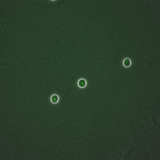  NCBI Organism:Saccharomyces cerevisiae; Cell Components:, nucleus, RENT complex, nucleolus; Biological process:chromatin silencing at rDNA, nucleolus organization, regulation of exit from mitosis, cell cycle, cell division, mitosis;