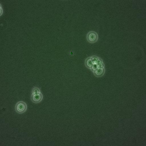  NCBI Organism:Saccharomyces cerevisiae; Cell Components:, nucleus, RENT complex, nucleolus; Biological process:chromatin silencing at rDNA, nucleolus organization, regulation of exit from mitosis, cell cycle, cell division, mitosis;