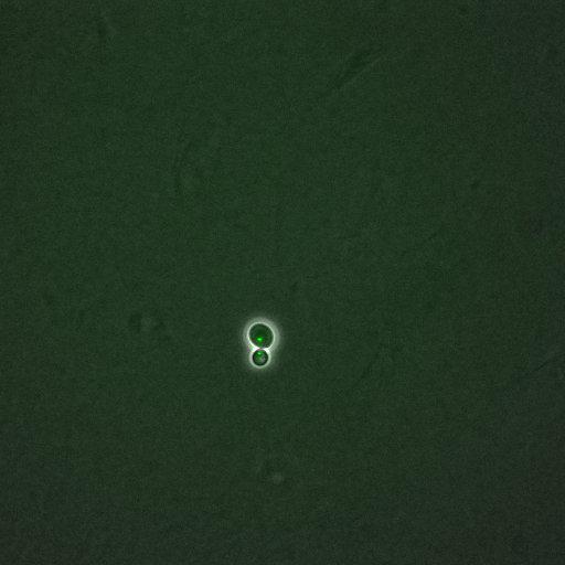  NCBI Organism:Saccharomyces cerevisiae; Cell Components:, nucleus, RENT complex, nucleolus; Biological process:chromatin silencing at rDNA, nucleolus organization, regulation of exit from mitosis, cell cycle, cell division, mitosis;