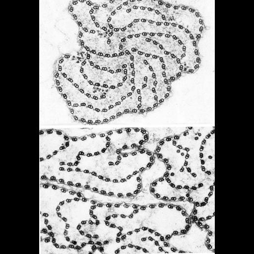  NCBI Organism:Monarthropalpus; Cell Types:sperm Cell Components:microtubule-based flagellum part Biological process:fertilization