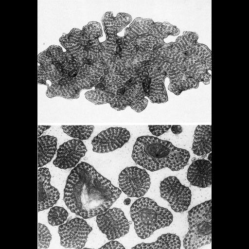  NCBI Organism:Cecidomyiinae; Cell Types:sperm Cell Components:microtubule-based flagellum Biological process:fertilization