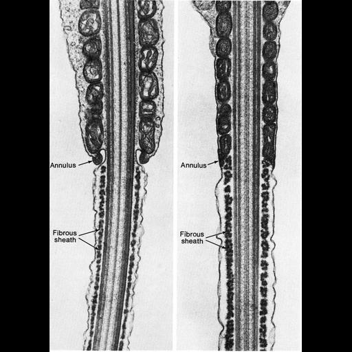  NCBI Organism:Neotragus moschatus, Chinchilla lanigera, ; Cell Types:sperm Cell Components:axoneme, axonemal microtubule; Biological process:fertilization