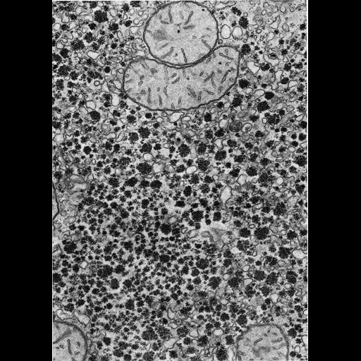  NCBI Organism:Phodopus; Cell Types:hepatocyte Cell Components:smooth endoplasmic reticulum, glycogen granule; Biological process:energy reserve metabolic process