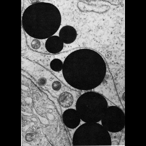  NCBI Organism:Didelphis virginiana; Cell Types:Sertoli cell Cell Components:lipid particle Biological process:lipid storage