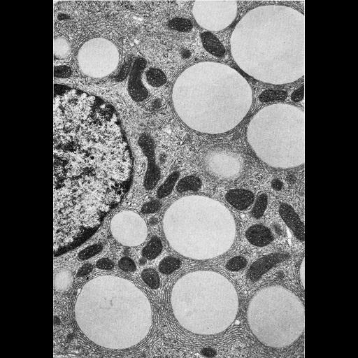  NCBI Organism:Spermophilus citellus; Cell Types:Leydig cell Cell Components:lipid particle, smooth endoplasmic reticulum; Biological process:lipid storage