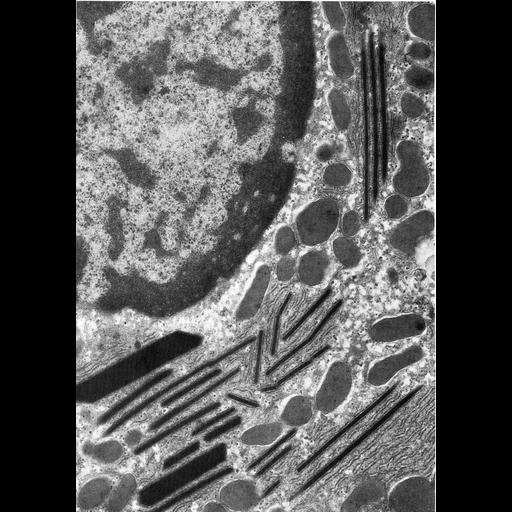  NCBI Organism:Batrachoseps attenuatus; Cell Types:hepatocyte Cell Components:inclusion body, endoplasmic reticulum;