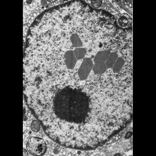  NCBI Organism:Homo sapiens; Cell Types:Leydig cell Cell Components:nuclear inclusion body, nucleus;