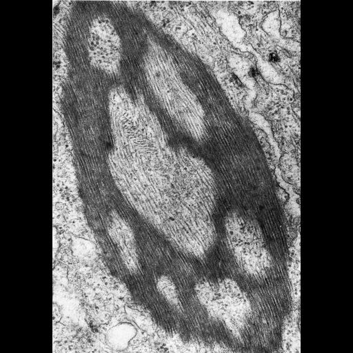  NCBI Organism:Homo sapiens; Cell Types:Sertoli cell Cell Components:inclusion body