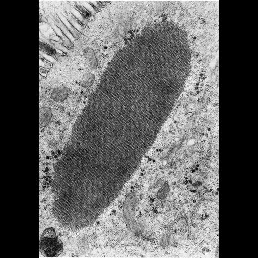  NCBI Organism:Campylenchia latipes; Cell Types:ciliated epithelial cell Cell Components:inclusion body, ferritin complex;