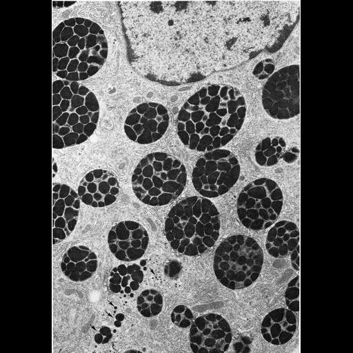  NCBI Organism:Rhipicephalus appendiculatus; Cell Types:secretory cell Cell Components:secretory granule, Golgi apparatus; Biological process:secretory granule organization