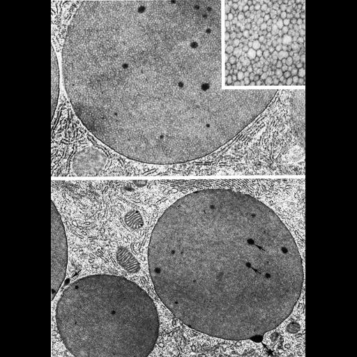  NCBI Organism:Rhipicephalus appendiculatus; Cell Types:secretory cell Cell Components:secretory granule, Golgi apparatus; Biological process:secretory granule organization