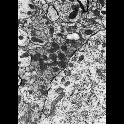  NCBI Organism:Rattus; Cell Types:CNS neuron (sensu Vertebrata) Cell Components:synapse, axon terminus, neuronal cell body, synaptic vesicle, mitochondrion; Biological process:synapse organization