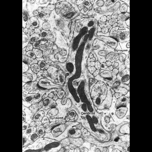  NCBI Organism:Rattus; Cell Types:CNS neuron (sensu Vertebrata), Purkinje cell; Cell Components:excitatory synapse, dendritic spine, synaptic vesicle, postsynaptic density, dendrite, axon, mitochondrion; Biological process:synapse organization