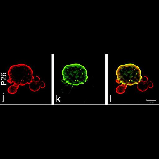  NCBI Organism:Homo sapiens; Cell Types:fibroblast Cell Components:nuclear envelope